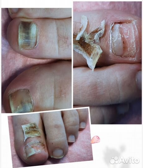 Подолог-педикюр