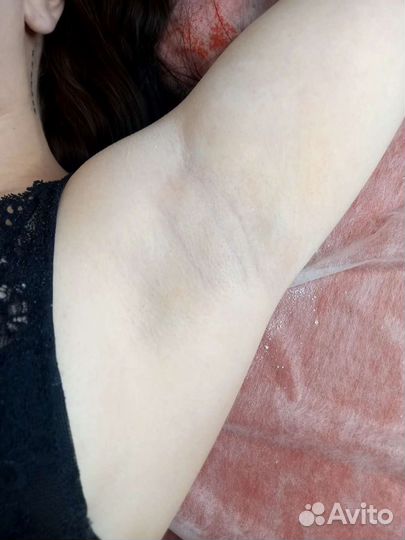 Мужской Шугаринг/Женский шугаринг