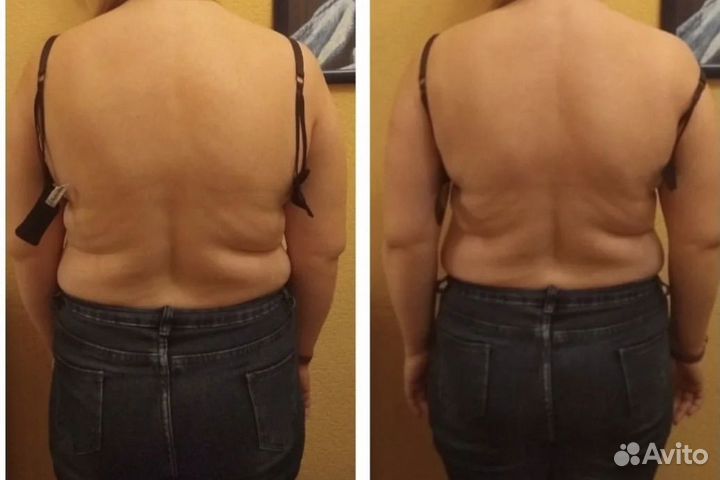 Выравнивание тела