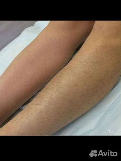 Бикини-дизайн