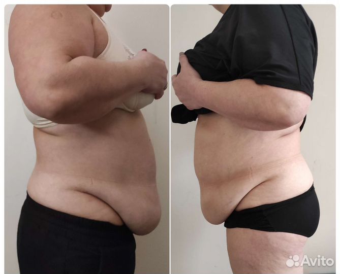 Массаж для женщин