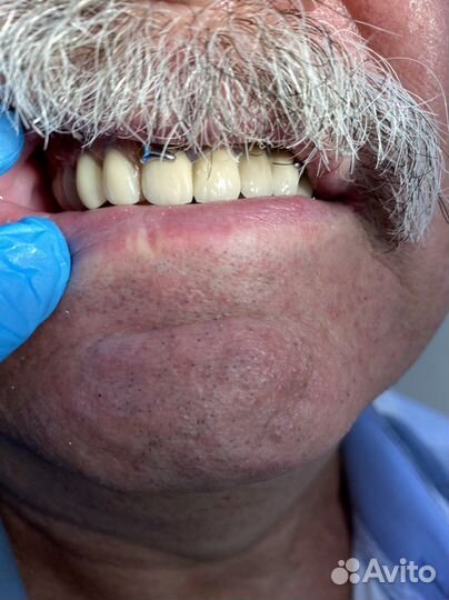 Стоматолог-ортопед