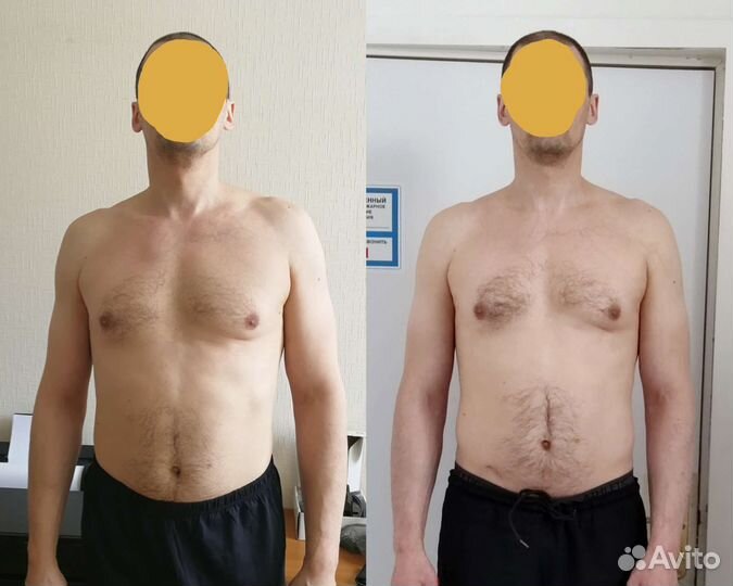 Остеопластика, биодинамика