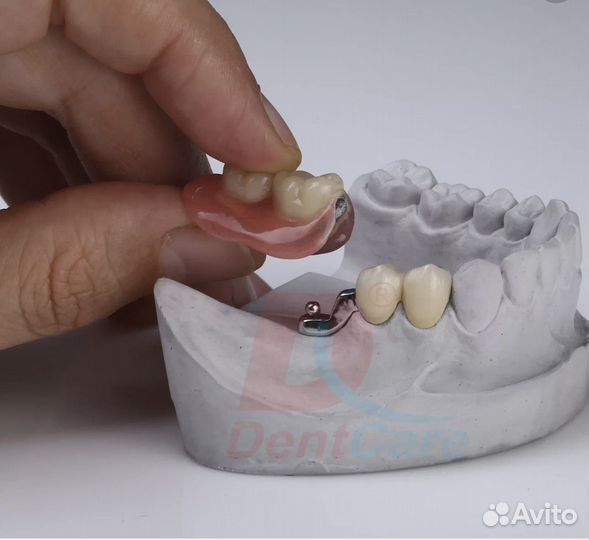 Изготовление съемных протезов