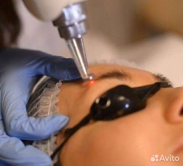 Удаление татуажа лазером,ремувером. Обучение