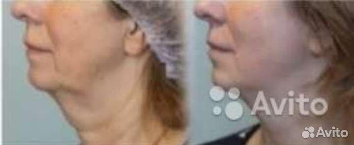 Массаж для женщин на Спартановке