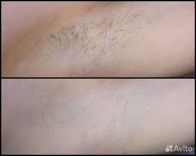 Воск / шугаринг