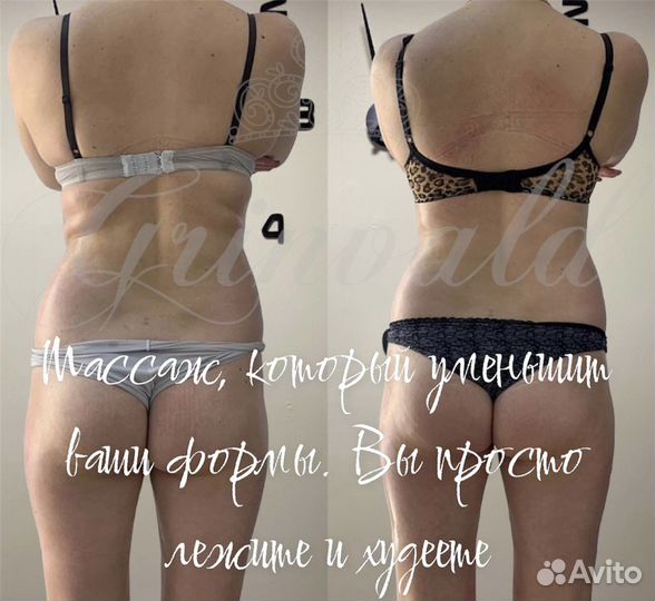Коррекция фигуры. Антицеллюлитный массаж. Гатчина