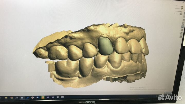 3D моделировка exocad, 3 shape