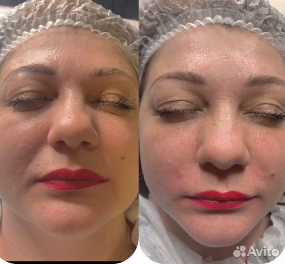 Косметология. Массаж «Эстетика тела»