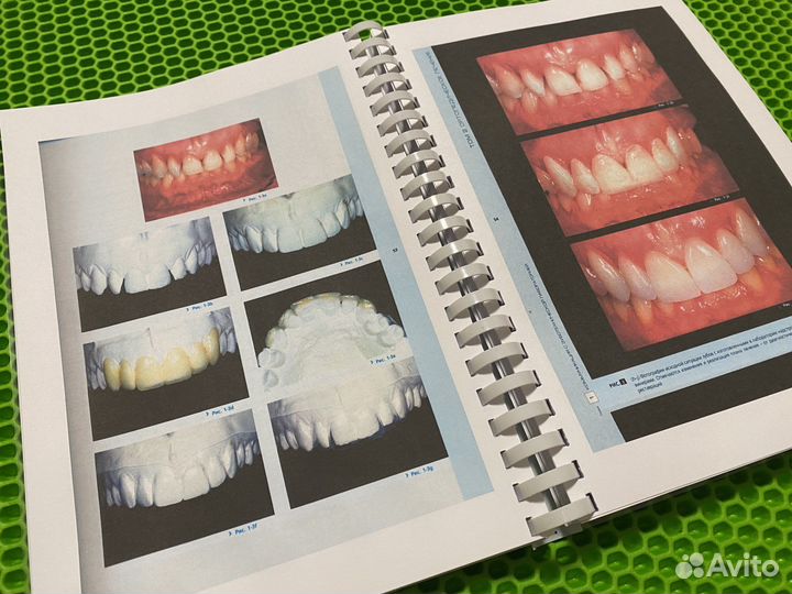 Анализ эстетики Том 2