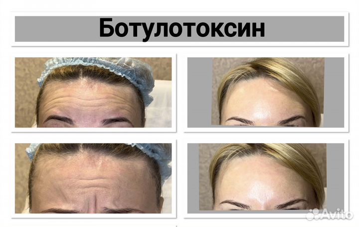 Услуги Косметолога