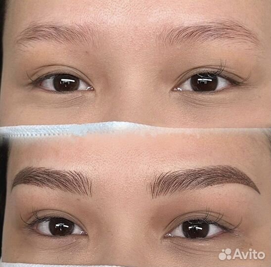 Микроблейдинг