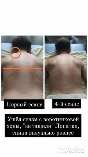 Массаж с выездом на дом