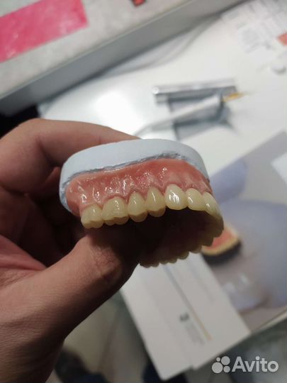 Зубной техник, протезирование зубов, зубы Vertex