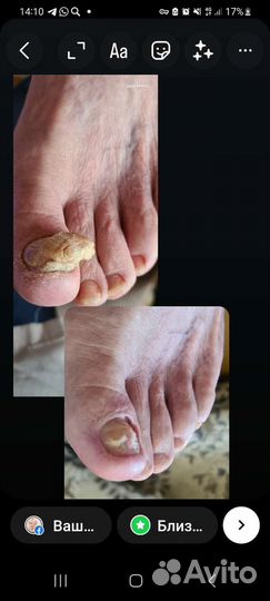 Аппаратный педикюр