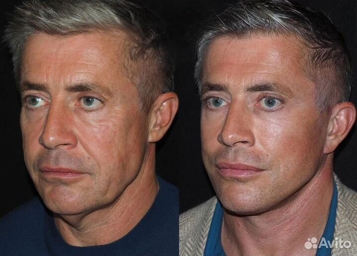 Программа омоложения для мужчин