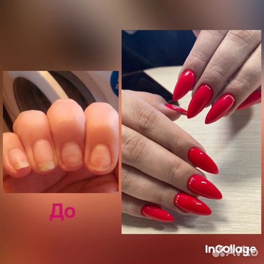 Наращивание и коррекция ногтей