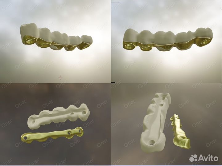 Blender for Dental (B4D) iBar балки и все модули