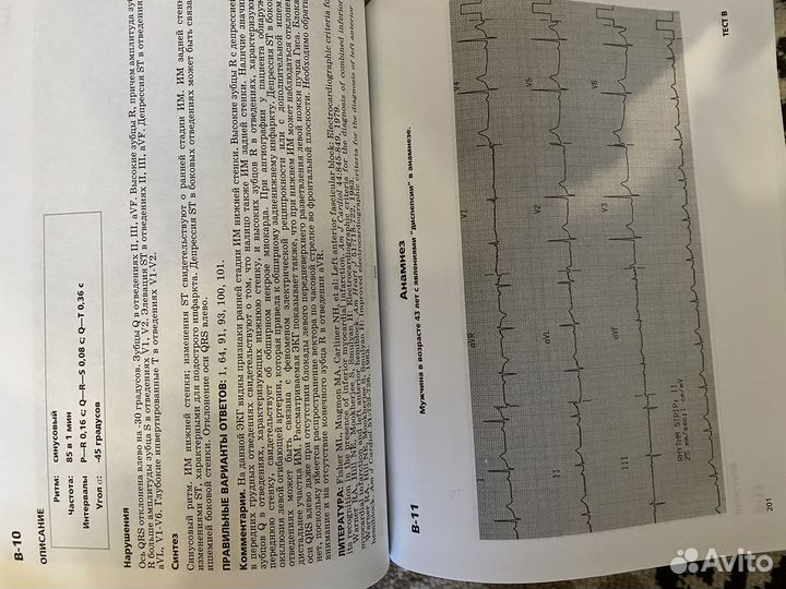 Клиническая электрокардиография