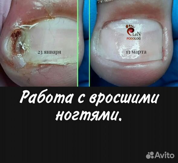 Подолог Ванино- Совгавань