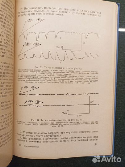 Электронистагмография при очаговых поражениях 1968