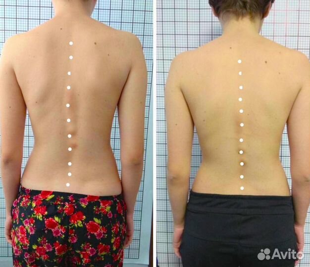 Массаж мануальный, костоправ. Результат с 1 сеанса