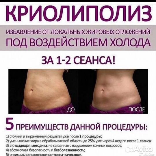 Криолиполиз
