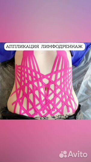 Тейпирование живота обучение