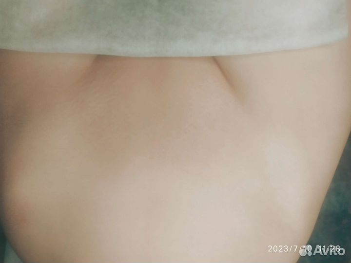 Шугаринг(сахарная депиляция)