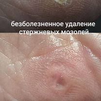 Подологический педикюр, Зеленоград