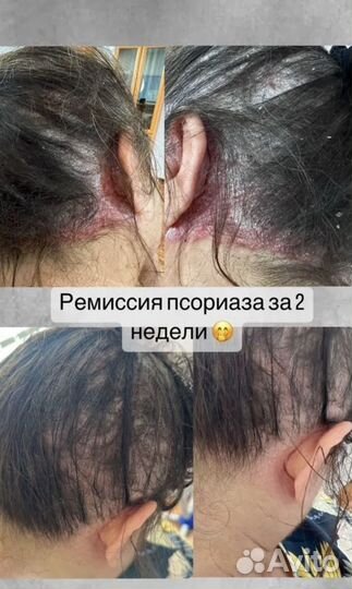 Онлайн Консультация врача-Дерматолога Косметолога