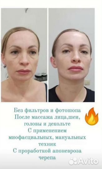 Массаж лица (скульптурный и моделирующий)