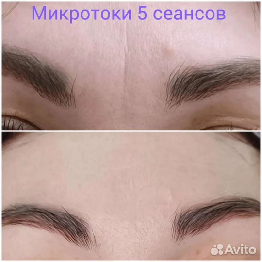 Массаж Карамельная липосакция, EMS прокачка мышц