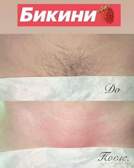 Мастер шугаринга