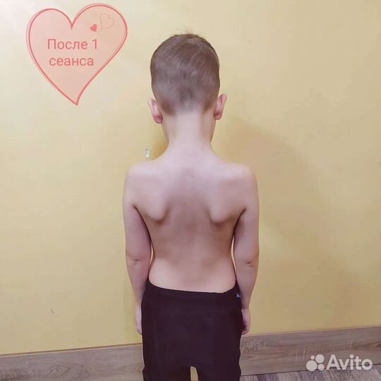 Массаж Оздоровительный - Костоправие