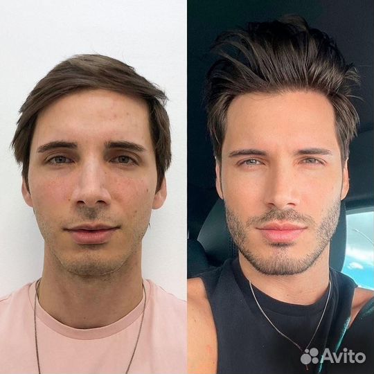 Программа омоложения для мужчин