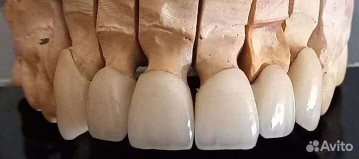 Зуботехнические услуги