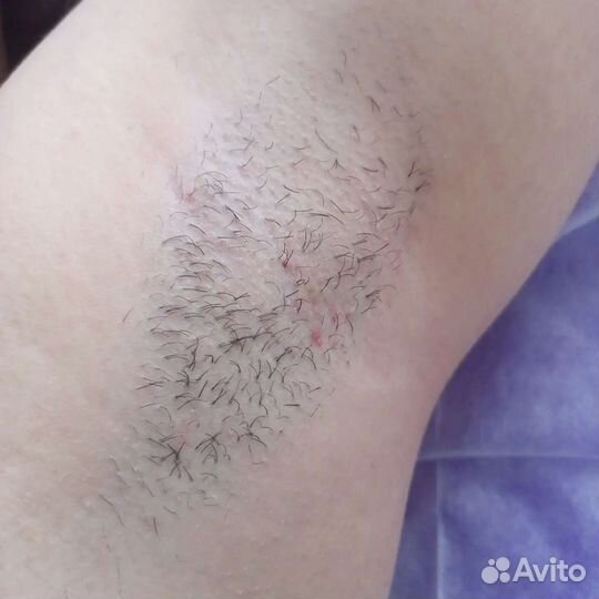 Депиляция воском