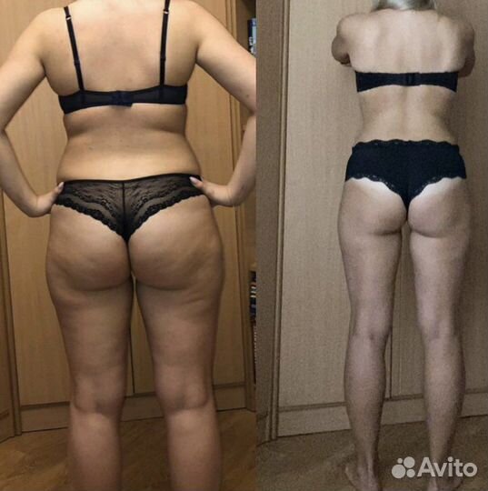 Тренер-реабилитолог; инструктор лфк