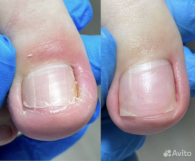 Услуги подолога