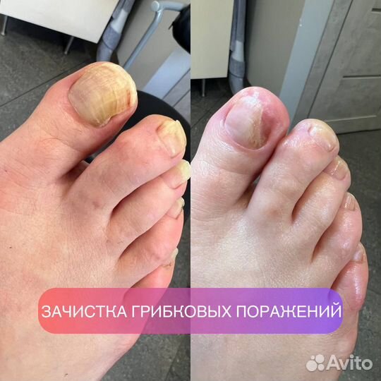 Лечебный педикюр подолог маникюр