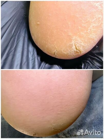 Модель маникюр/педикюр подология