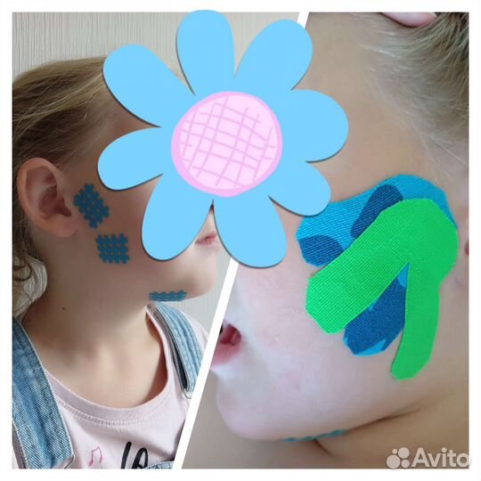 Логопедический массаж. логотейпирование