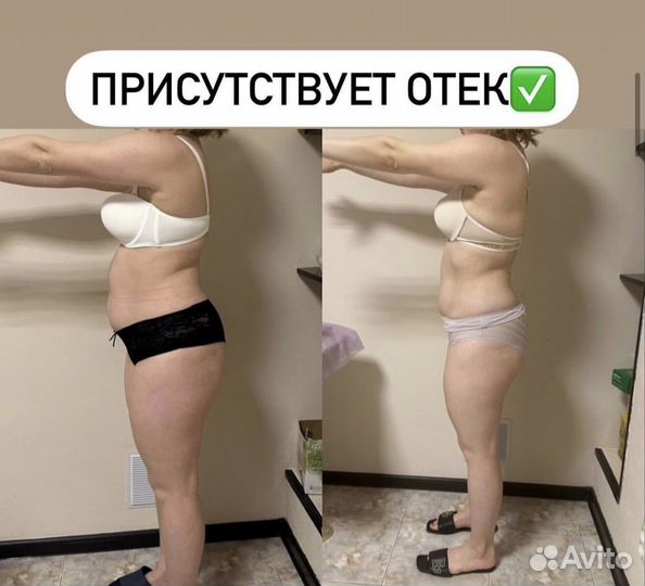 Массаж