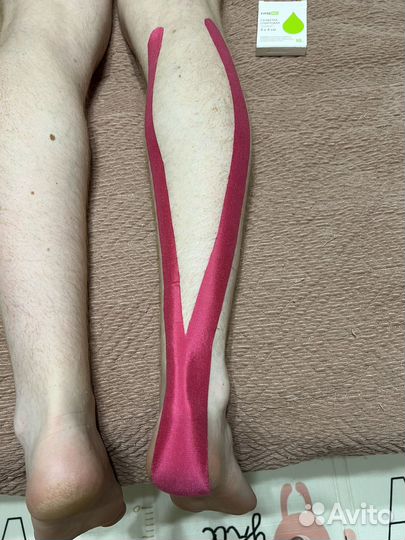 Тейпирование