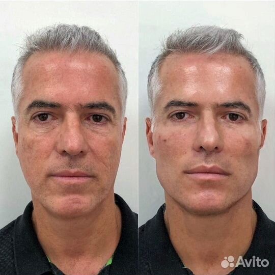 Программа омоложения для мужчин