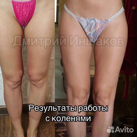 Лимфодренажный массаж