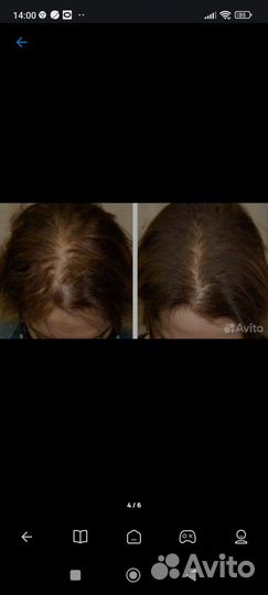 Красивый,густой Волос