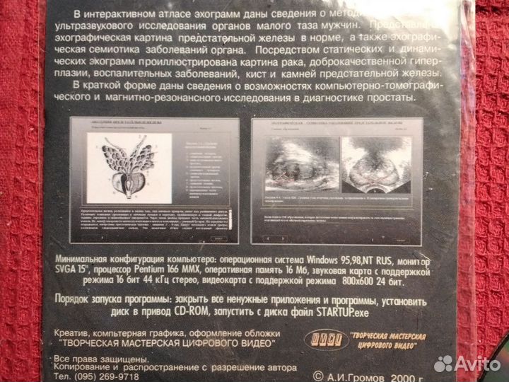 Атлас эхограмм предстательной железы Громов А.И